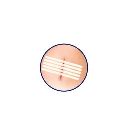 Sterile Adhesive Strips – 2