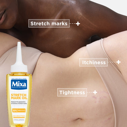 Mixa Anti Stretch Mark Oil - For Skin with Stretch Marks - With 30% Omega 6 & 9 - 100 ml