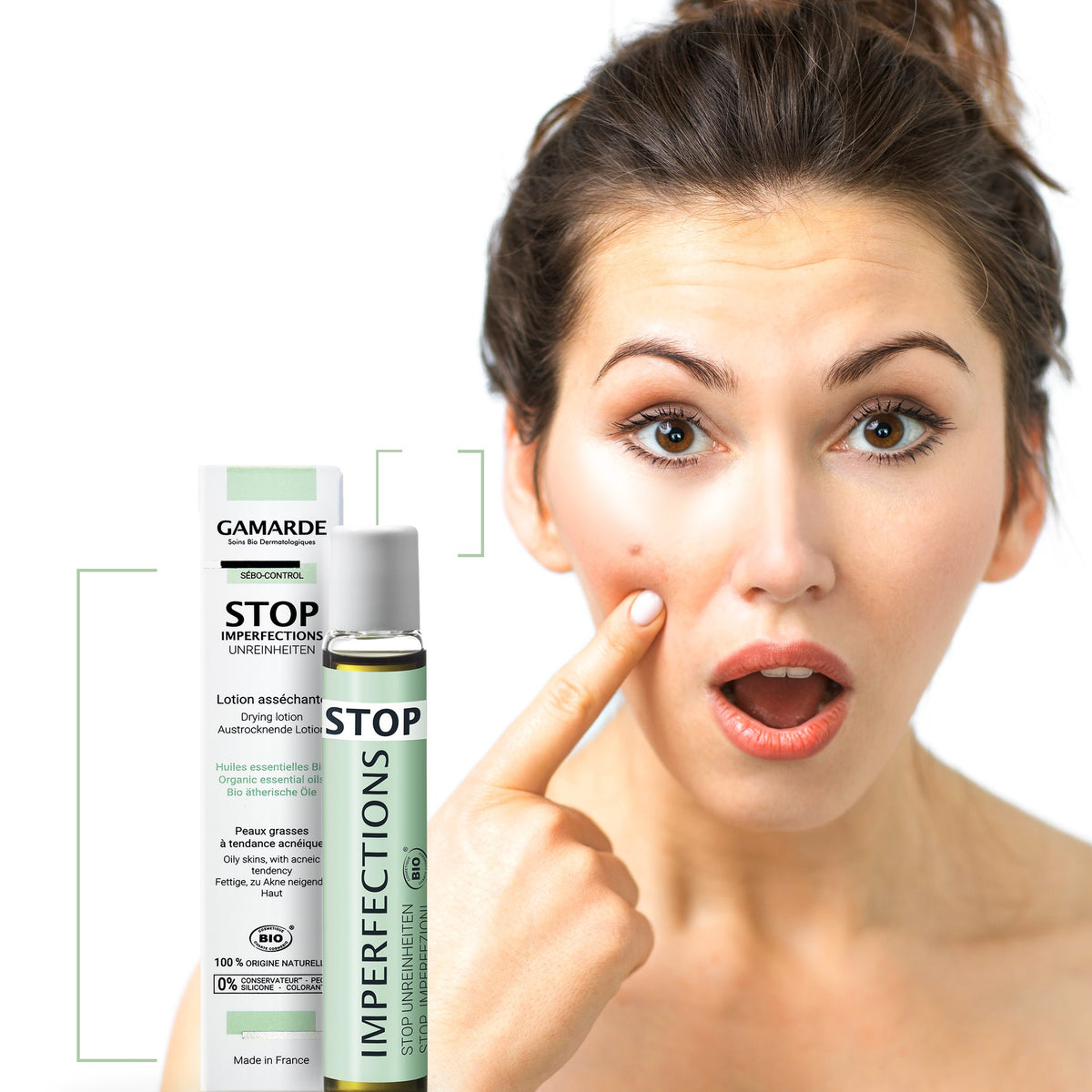 Drying Lotion – 5