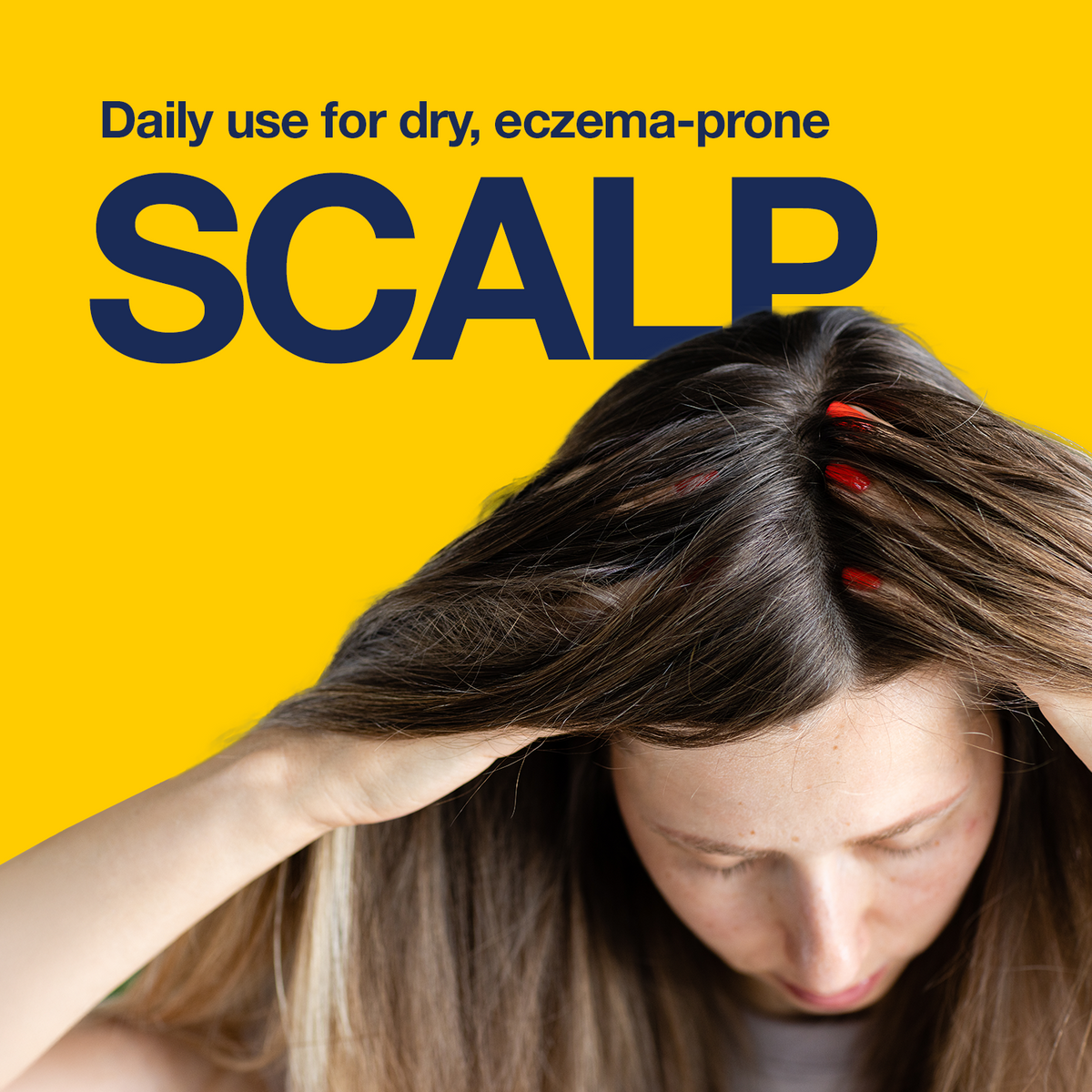 Care Dry Scalp SHAMPOO200ML – 5