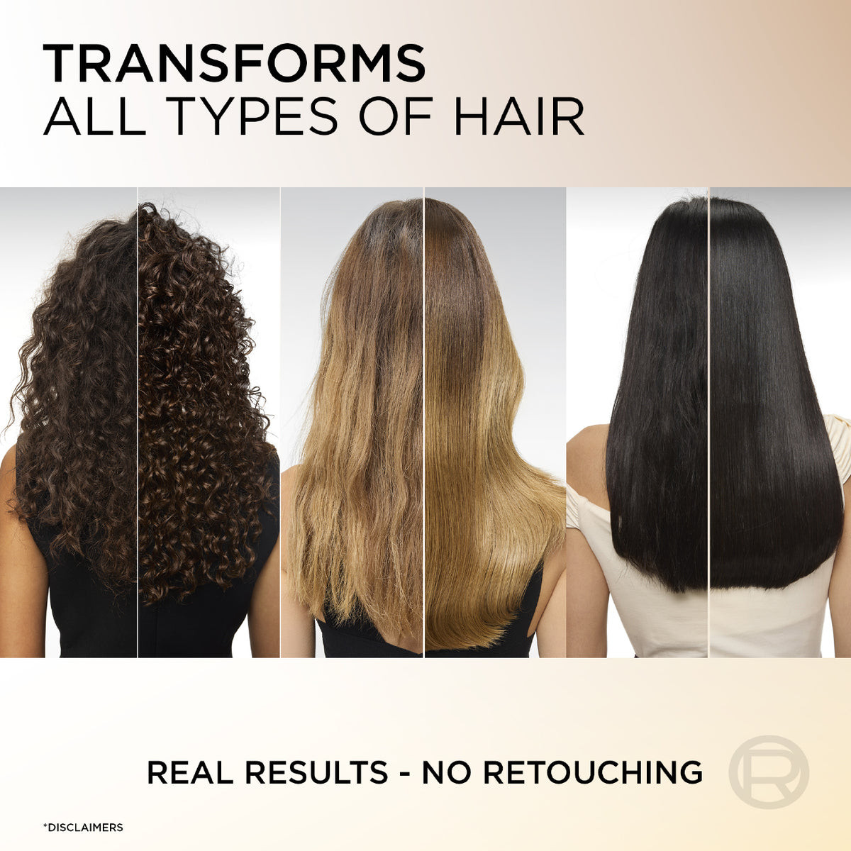 L’Oréal Paris Elvive Extraordinary Hair Oil Treatment, Non-Sticky Serum For Dry Hair-100ml