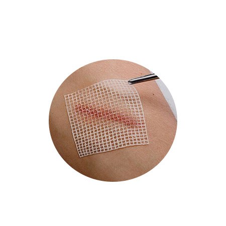 Sterile Paraffin Gauze (10cm*10cm) – 1