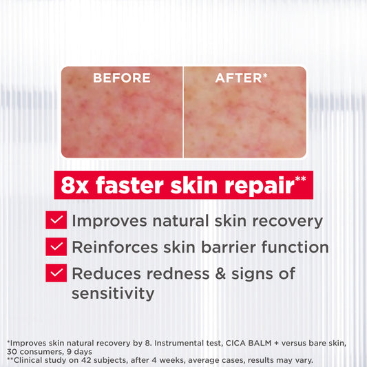 Mixa Cica Balm+ Multi-Purpose Repair Balm for Damaged & Irritated Skin 50ml – Fast Skin Recovery Care for Chapped, Burned & Sensitive Skin