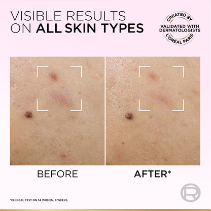 L’Oréal Paris Glycolic-Bright Anti-Dark Spot Exfoliant Peel 15% AHA + BHA + PHA + Niacinamide 25ml.
