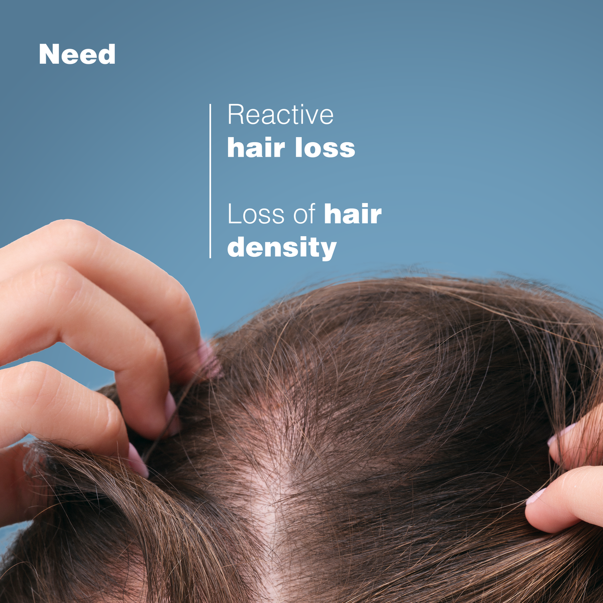 Ducray Anaphase Anti-hair loss Anti-thinning Shampoo – 8