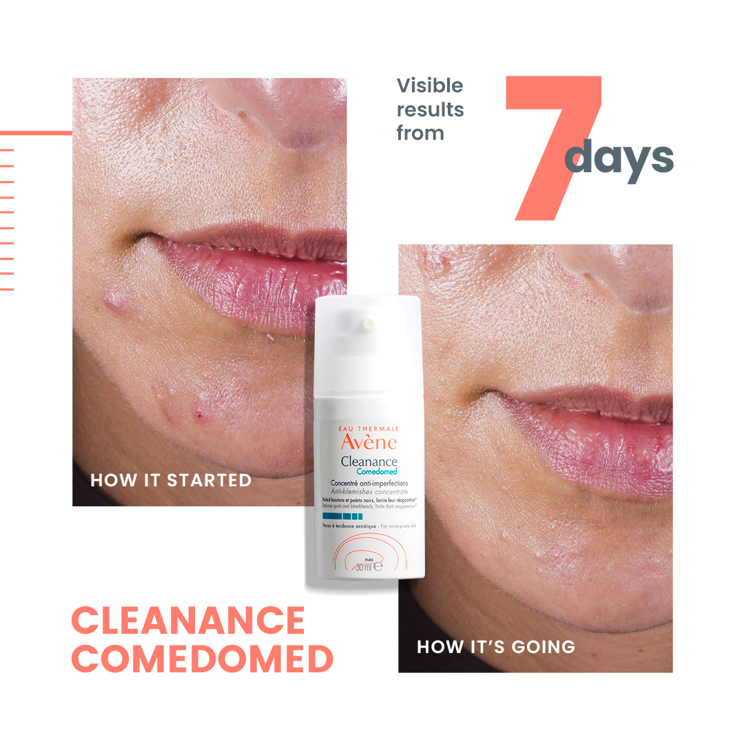Avène Cleanance Comedomed Anti-Blemish Concentrate – 6
