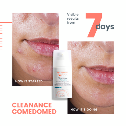 Avène Cleanance Comedomed Anti-Blemish Concentrate – 6