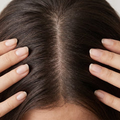 Hair loss