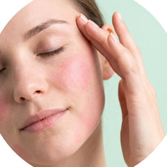 Sensitive skin